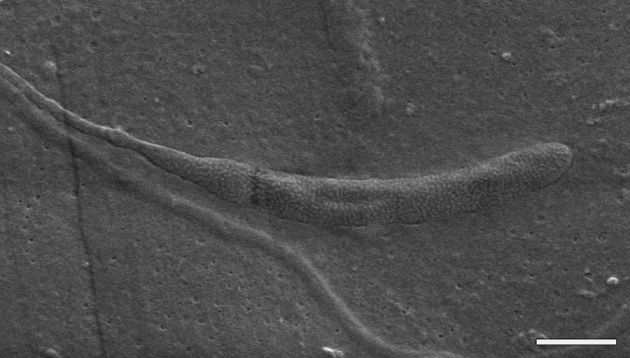 Η εκσπερμάτιση των 50 εκατομμυρίων ετών